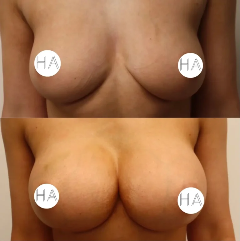 photo-output+(9)